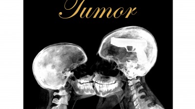 Tumor